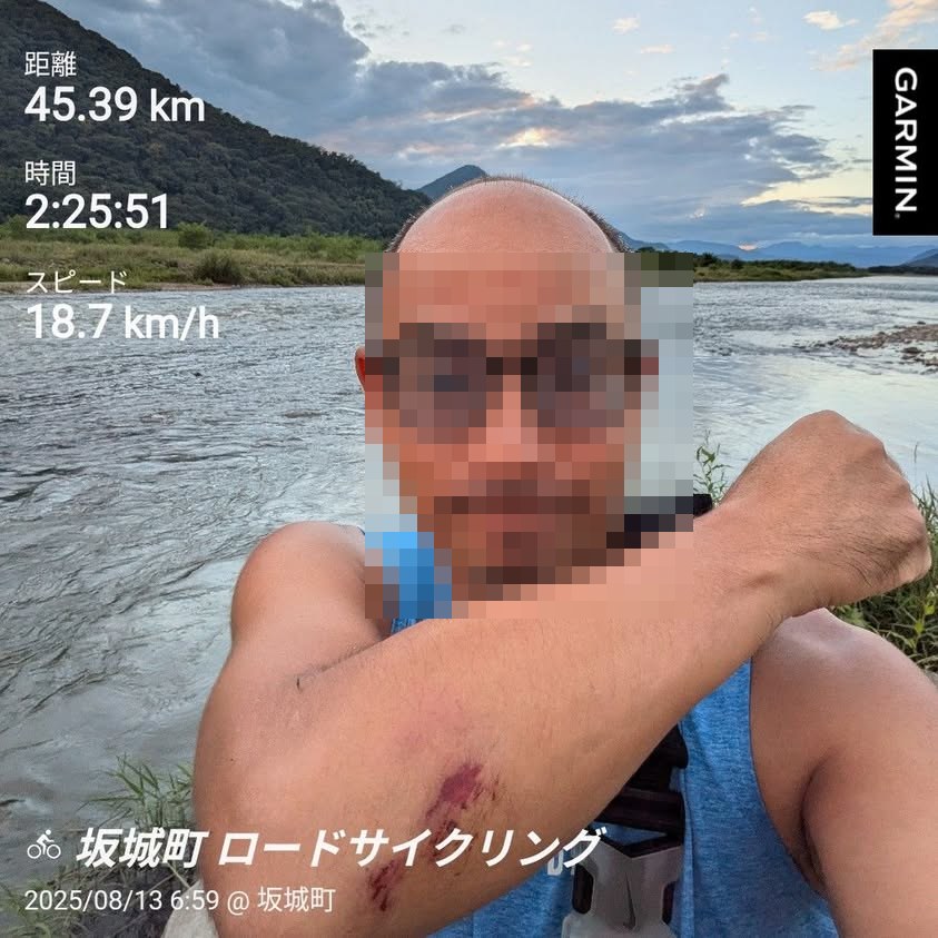落車後の擦過傷が残る腕とサイクリングの記録